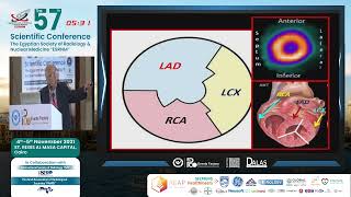 Myocardial Perfusion Scintigraphy [upl. by Myrlene661]