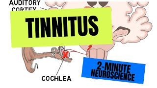 2Minute Neuroscience Tinnitus [upl. by Trina]