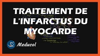 Traitement infarctus du myocarde  médicaments de lurgence thrombolyse et traitement au long cours [upl. by Chainey308]