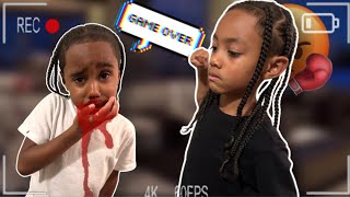 KID GIVES BROTHER BLOODY NOSE  WHAT HAPPENS NEXT IS SHOCKING [upl. by Aletse]