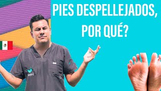 Pies despellejados y resecos causas Video actualizado 2020 [upl. by Trudie905]