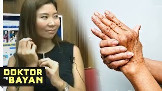 Tips sa Rayuma Lupus at Arthritis  ni Doc Ging ZamoraRacaza 7b [upl. by Annorah851]