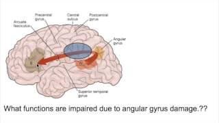 PROSOPAGNOSIA Face blindnessANGULAR GYRUS LESIONS [upl. by Ansley]