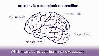 What is epilepsy  Epilepsy Society [upl. by Eniliuqcaj]