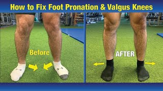 VERY EFFECTIVE Way to FIX Pronated feet amp Knees Caving In Valgus Knees [upl. by Chaworth]