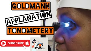 Goldmann Applanation Tonometer  Tonometry [upl. by Alliuqa]