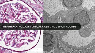 20240820 Nephropathology Clinical Case Discussion Rounds [upl. by Vivi]