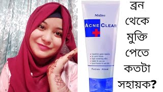 Mistine acne clear facewash review  ফেশওয়াস টি আসলে কেমন সত্যি কি ব্রন কমাতে সাহায্য করে [upl. by Odradlig]