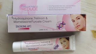 Elosone Ht Cream Benefit amp Hydroquinone amp Tretinoin amp Mometasone Cream Uses [upl. by Idur]