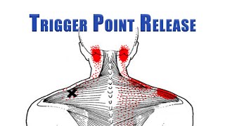 Trigger Point Release  Upper Trapezius Levator Scapulae and Suboccipitals  No Tools Needed [upl. by Mauralia689]