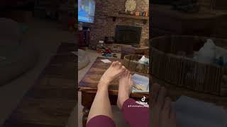 My foot dystonia before DBS surgery dystonia parkinsonsdiseaseawareness feet [upl. by Ardaid]