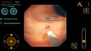 Gastro Ex Video Game for Gastroenterologists [upl. by Rayle561]