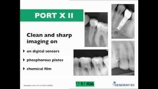 Port XII  Genoray mobile dental xray [upl. by Uphemia]