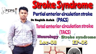 Stroke syndrome  TACS amp PACS by Dr Raghib Asfak  Neurology Lec08 Easy amp Bangla Explanation [upl. by Inama]