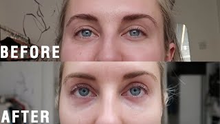 XLASH EYELASH SERUM REVIEW amp RESULTS  STYLE LOBSTER AD [upl. by Naivaj]