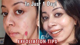 5 Exfoliation Tips for Clear Skin amp Glow How to exfoliate with Chemical Peels exfoliators [upl. by Nit]