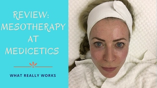 Review of Mesotherapy treatment at Medicetics clinic [upl. by Aikal]