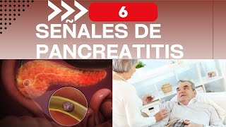 6 señales de que tendrás pancreatitis [upl. by Swigart98]