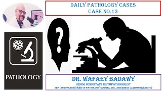 DAILY PATHOLOGY CASES CASE NO 13 BY Dr WAFAEY BADAWY [upl. by Valdis]