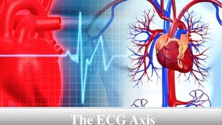 ECG Axis Tutorial Part 3  Determining QRS Axis [upl. by Beutner516]