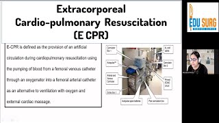 Extracorporeal cardiopulmonary resuscitation E CPR  Saving a life with ECMO  Future of CPR [upl. by Oflodor]