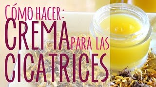 Crema casera para las cicatrices [upl. by Haggai404]