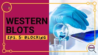 Western Blot Introduction to Blocking [upl. by Ulu]