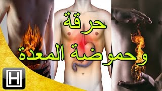 علاج حرقة المعدة والحموضة طبيعيا وبأفضل وأسهل الوصفات [upl. by Nirtiak863]