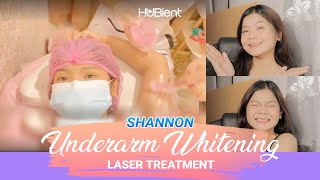 Underarm Whitening Laser Treatment  Eliza [upl. by Albion]