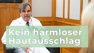 57 Gürtelrose Kein harmloser Hautausschlag  Sprechstunde am Uniklinikum [upl. by Ohaus]