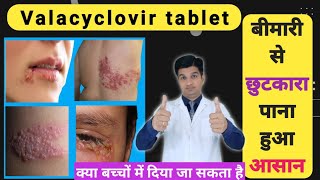 नहीं सहनी पड़ेगी यह दर्दनाक बीमारी  Valcivir 1000 mg tablet uses in hindi [upl. by Artemis788]