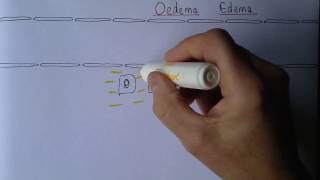 Edema exudates or transudates [upl. by Tulley669]