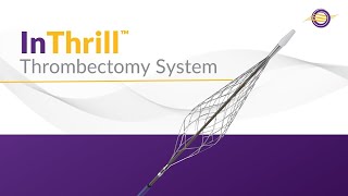 InThrill Thrombectomy System [upl. by Ynaffik299]