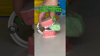 FREEZE DRIED CANDY vs BRACES DENTIST REACTS braces candy shorts ​⁠​⁠​⁠​⁠​⁠​⁠TrendyTreats [upl. by Rodavlas]