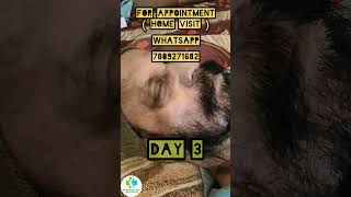 facial palsy physiotherapy shorts short trending viral viralvideo patient hospital best [upl. by Treiber]