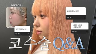 가짜코 등장 코수술 1달차 QampA👃🏻돌출입 비순각 교정 붓기관리 코 라인 맞춤형실리콘 병원 정보 부작용 등•• 다 알려드립니다🗣💭 [upl. by Issie]