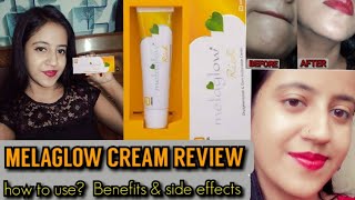 Melaglow Rich Cream Reviewhow to usebenefits amp side effectDe pigmenting amp glow restoration cream [upl. by Neeloc]