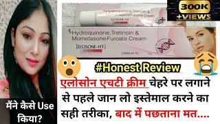 Elosone HT cream review Uses  Best Fairness cream for marke  Elosone HT Benifits and side effects [upl. by Cecilia628]