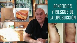 EL DR ENSEÑA  BENEFICIOS Y RIESGOS DE LA LIPOSUCCIÓN [upl. by Jed825]