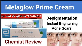 Melaglow Prime Cream Review l Melaglow Prime Cream Uses in Urdu hindi [upl. by Lenrad]