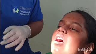 Pediatric dentistry A knowledge video of administration of local anesthesia in children [upl. by Cressida]