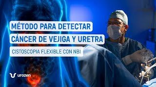 Cistoscopia Flexible con NBI  Diagnóstico 👨‍⚕️ [upl. by Nedaj]