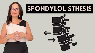 057 Dr Furlan Reveals the 5 Questions You Need to Know About Spondylolisthesis [upl. by Hsac]