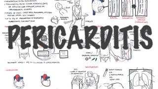 Pericarditis  Overview signs and symptoms pathophysiology diagnosis treatment [upl. by Lucian]