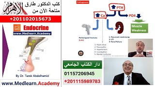 Hyperparathyroidism cme internalmedicine usmle medical محاضراتباطنة [upl. by Eatnhoj]