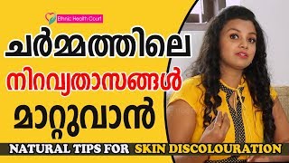 Skin Discoloration Treatment Home Remedies  Skin Pigmentation Home Remedies In MalayalamSkin Care [upl. by Downing]