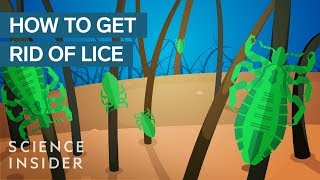 Why Lice Are So Hard To Kill [upl. by Redfield623]