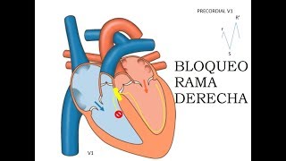 BLOQUEO RAMA DERECHA ECG EDWARCOOL [upl. by Lienhard903]