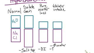Hypernatremia and Hyperchloremia [upl. by Eintihw304]
