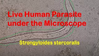 Human Parasites Live under the Microscope  Strongyloides stercoralis [upl. by Mcclees]